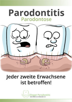 Broschüre Stoppt Parodontitis